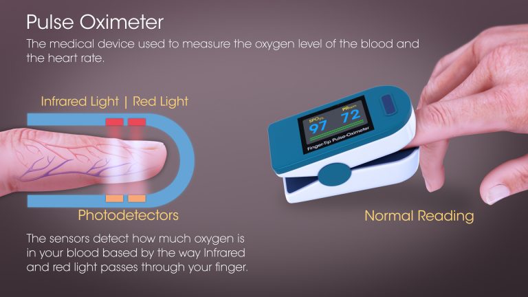 Pulse Oximeter - Image 2