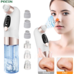 Blackhead Remover Vacuum with Water Chamber – Deep Pore Cleaner for Clear Skin